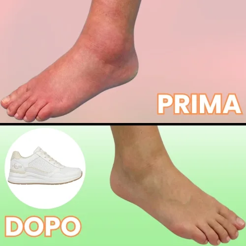 Stop a dolore e gonfiore